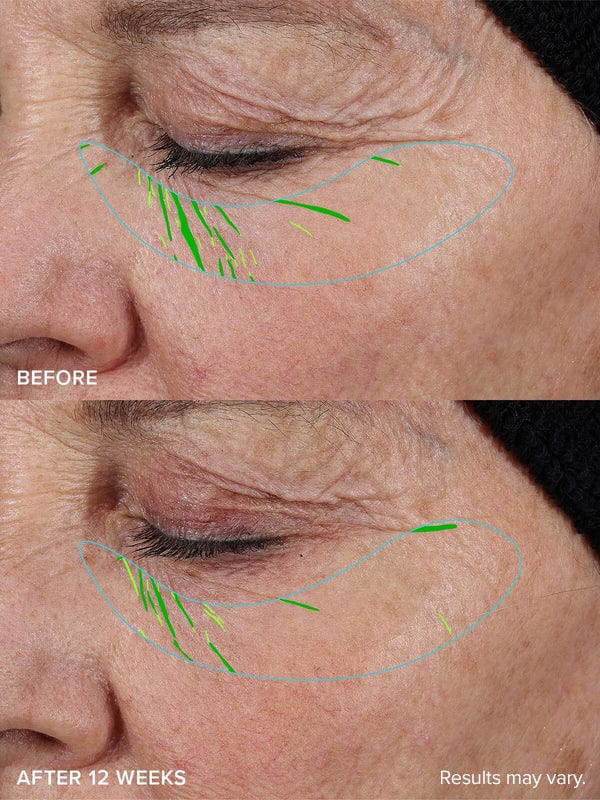 PureVa™ Needle-Free Growth Factor Serum