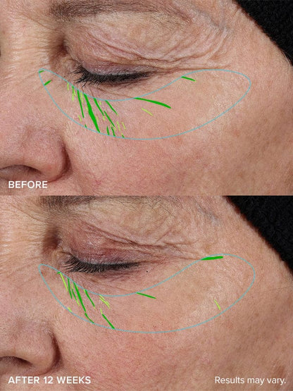 PureVa™ Needle-Free Growth Factor Serum